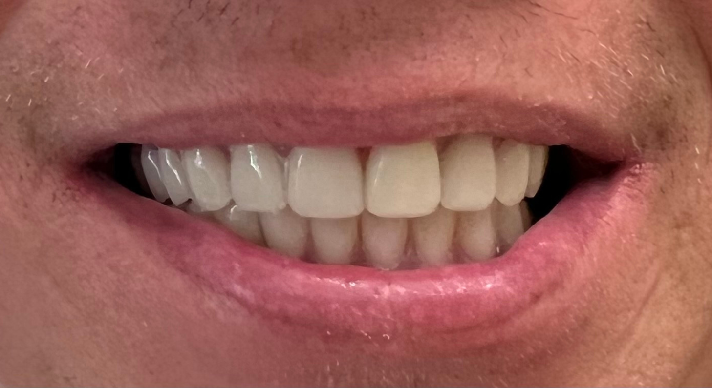 Smile Gallery in Wixom, MI Wixom Dental